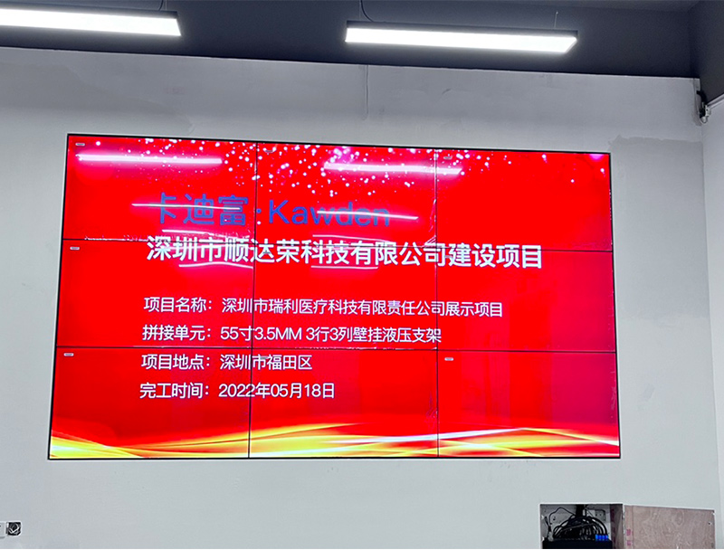 深圳医疗机构55寸壁挂3X3ray竞技app
展示